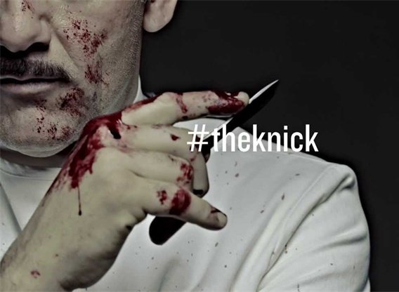 The Knick